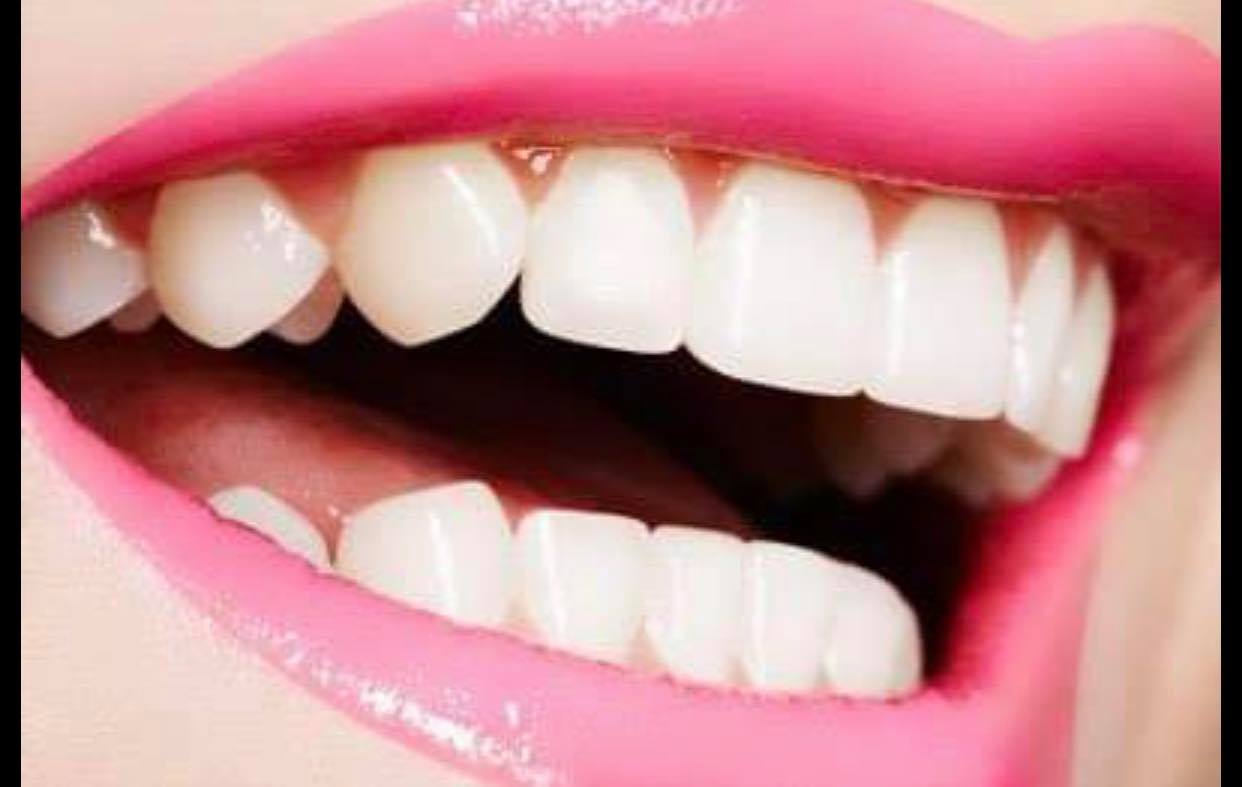 Why You Should Choose Dental Implants Instead of Dentures